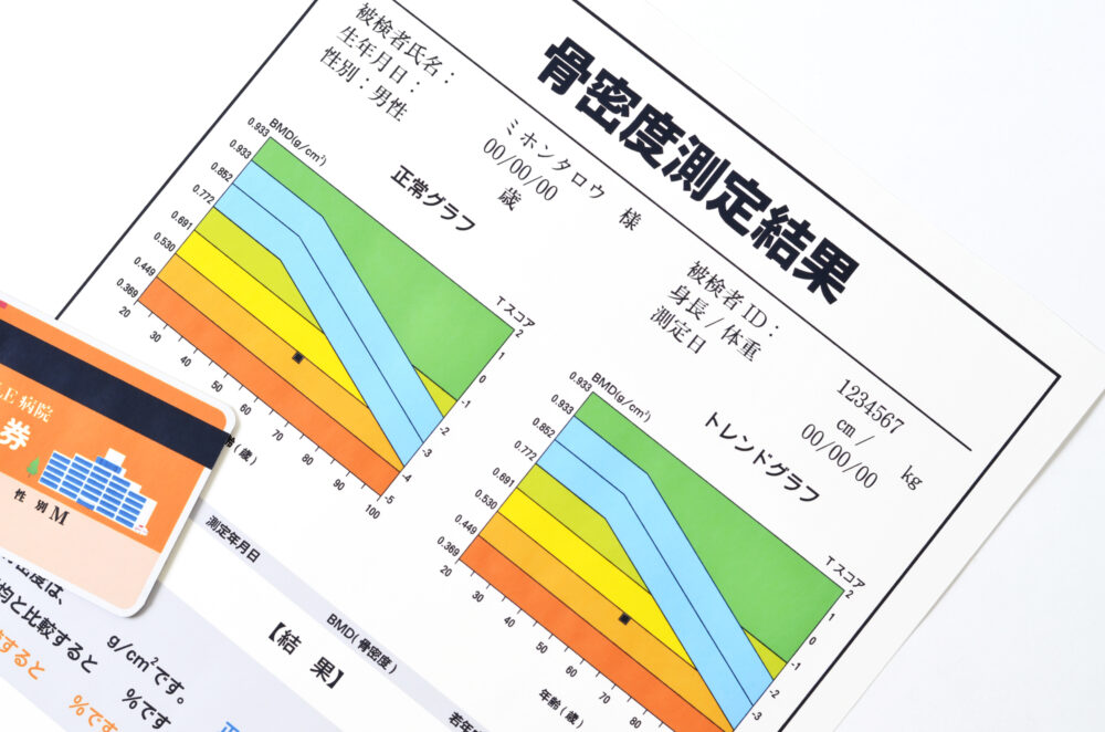 骨粗鬆症